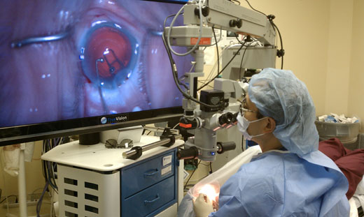 3dcataract05
